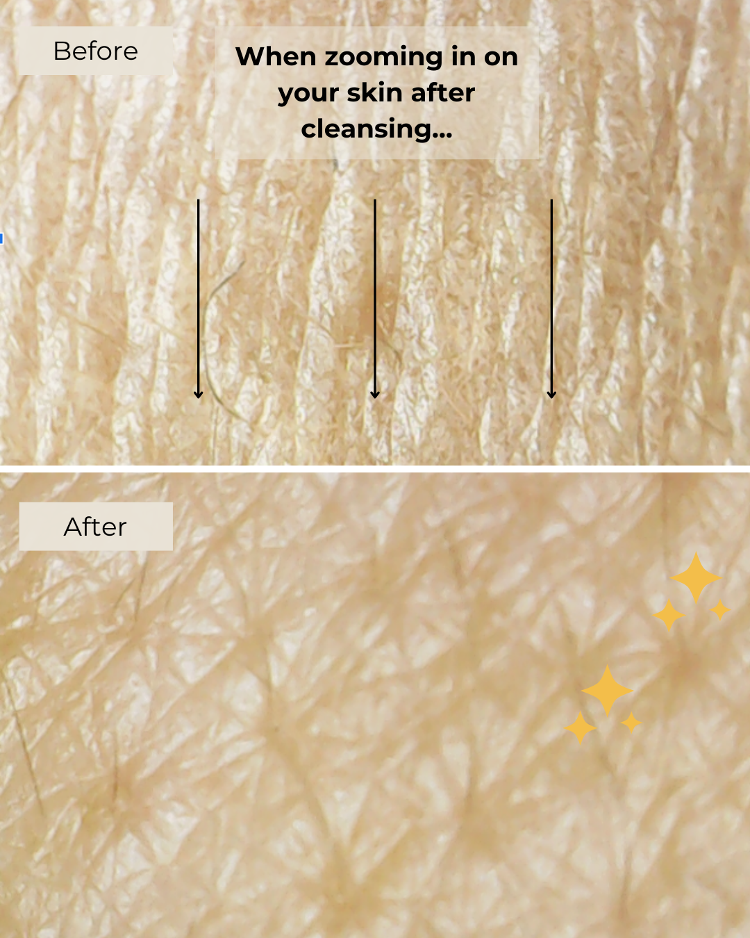 Gentle Cleansing Gel