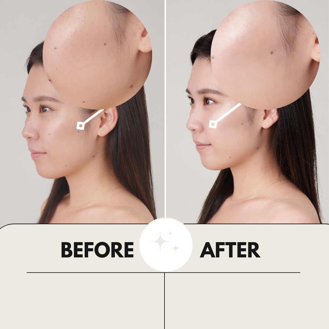 All-in-One-White Gel