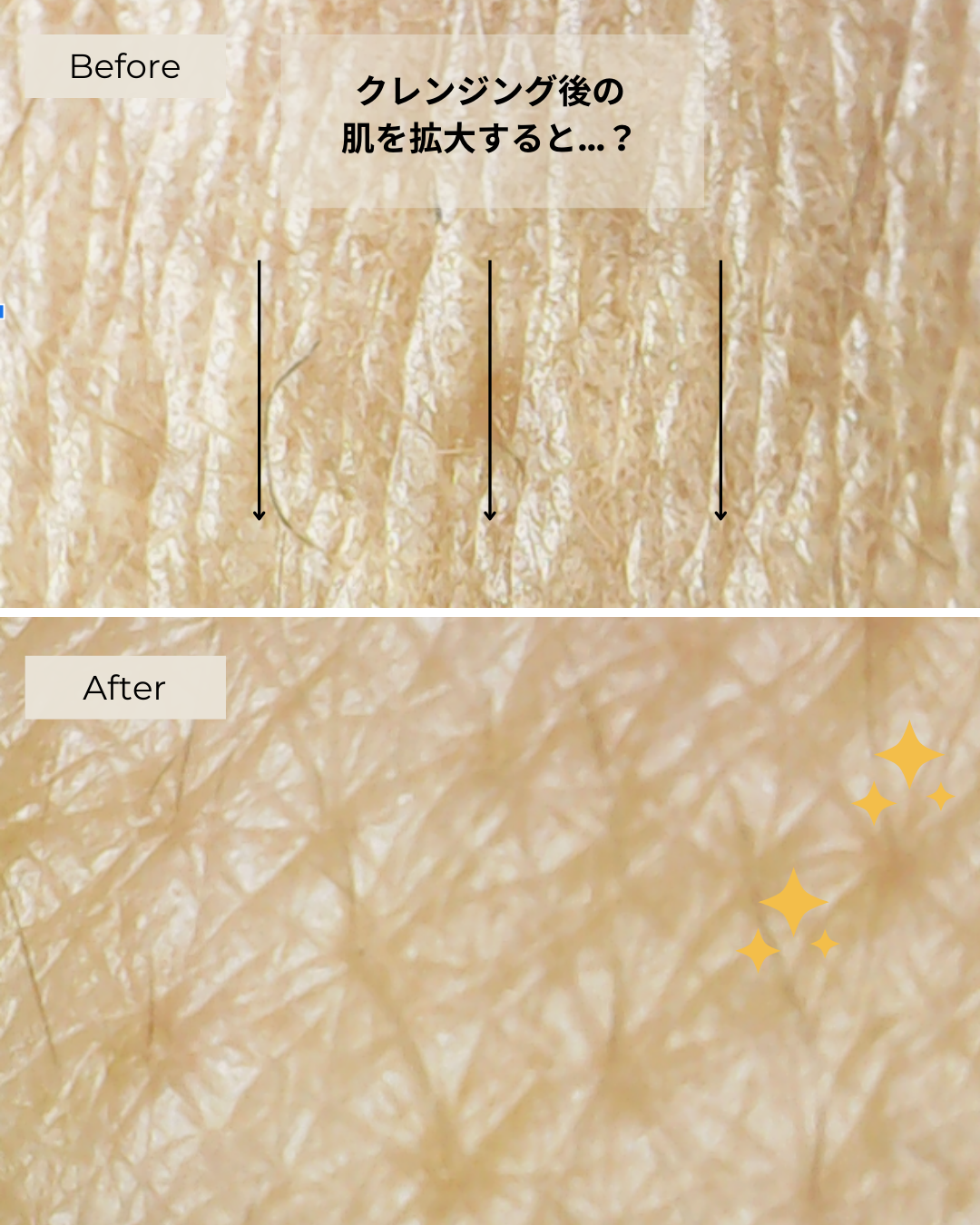 Gentle Cleansing Gel