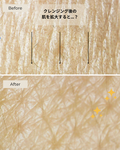 Gentle Cleansing Gel